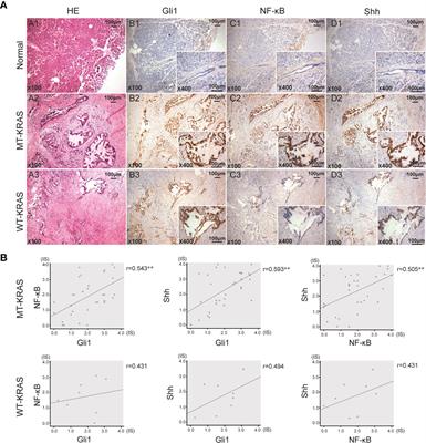 Positive Crosstalk Between Hedgehog and NF-κB Pathways Is Dependent on KRAS Mutation in Pancreatic Ductal Adenocarcinoma